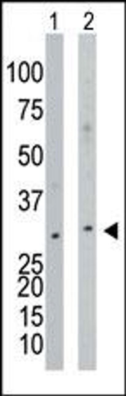 Antibody is used in Western blot to detect NAGK in mouse thymus tissue lysate (Lane 1) and Y79 cell lysate (Lane 2) .