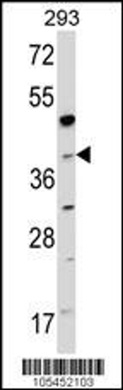 Western blot analysis of hNAGK-G315 in 293 cell line lysates (35ug/lane)