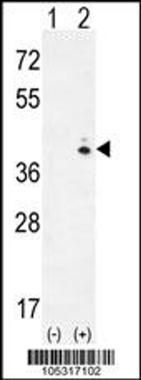 Western blot analysis of GALK1 using rabbit polyclonal hGALK1-A360 using 293 cell lysates (2 ug/lane) either nontransfected (Lane 1) or transiently transfected (Lane 2) with the GALK1 gene.