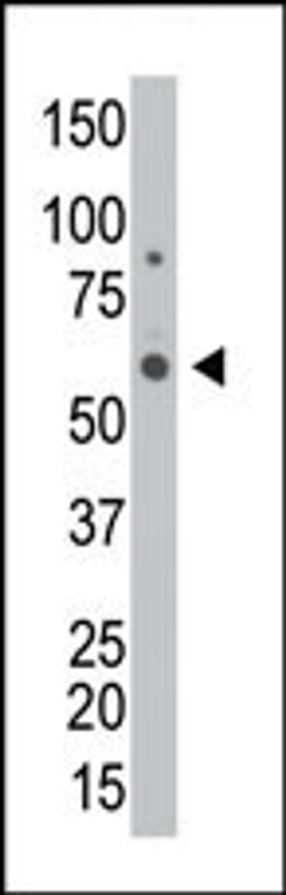 Antibody is used in Western blot to detect GALK2 in HL-60 cell lysate.