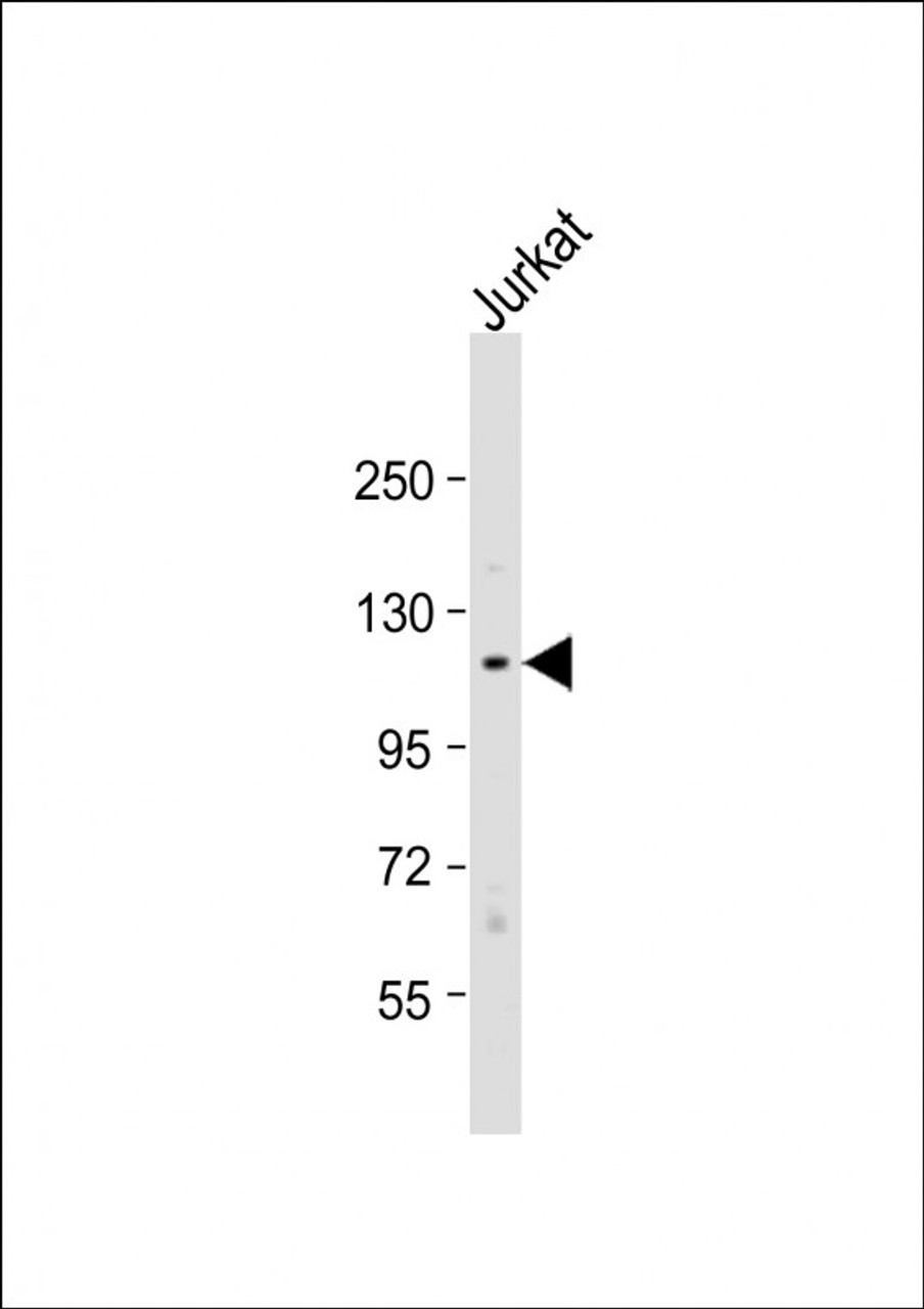 Western Blot at 1:1000 dilution + Jurkat whole cell lysate Lysates/proteins at 20 ug per lane.