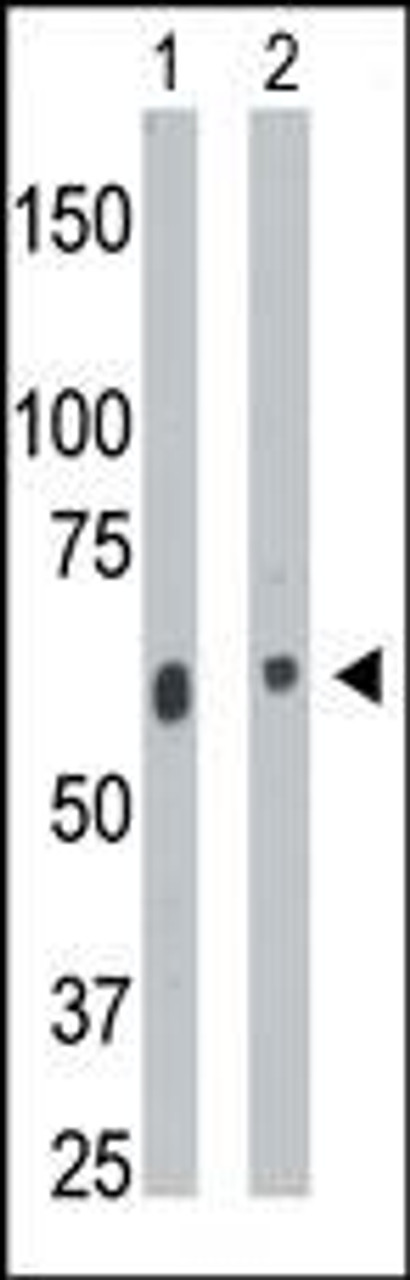 Antibody is used in Western blot to detect CERK in mouse heart tissue lysate (Lane 1) and A2058 cell lysate (Lane 2) .
