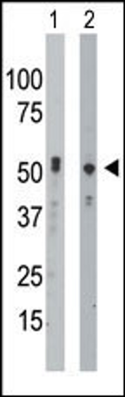 Antibody is used in Western blot to detect BCKDK in mouse intestine tissue lysate (Lane 1) and Hela cell lysate (Lane 2) .
