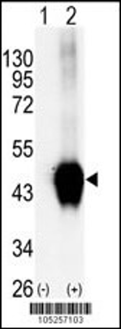 Western blot analysis of BCKDK using rabbit polyclonal.293 cell lysates (2 ug/lane) either nontransfected (Lane 1) or transiently transfected with the BCKDK gene (Lane 2) .