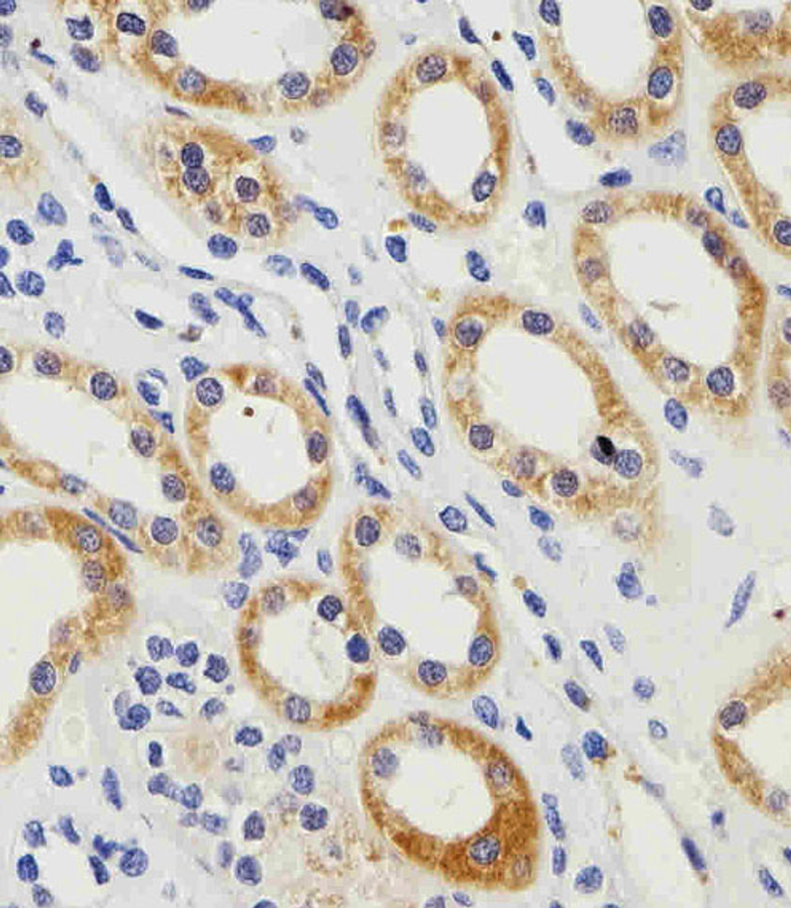 Immunohistochemical analysis of paraffin-embedded H. kidney section using PGK1 Antibody . Antibody was diluted at 1:100 dilution. A peroxidase-conjugated goat anti-rabbit IgG at 1:400 dilution was used as the secondary antibody, followed by DAB staining.