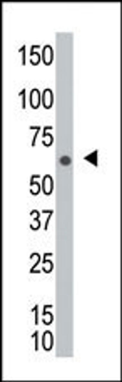 Antibody is used in Western blot to detect NEK8 in A2058 cell lysate.