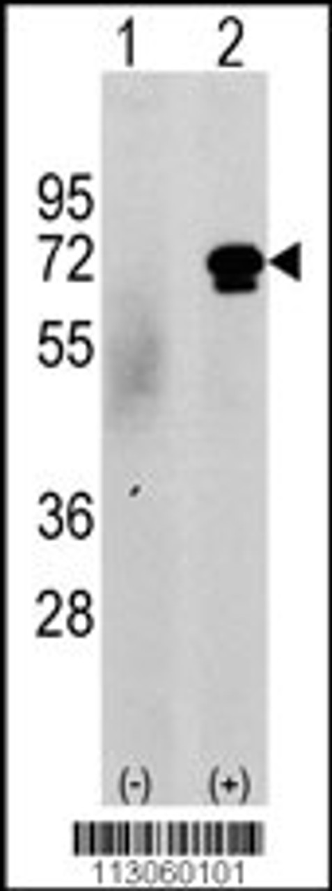 Western blot analysis of CAMKK2 using rabbit polyclonal CAMKK2 Antibody (N-term G67) using 293 cell lysates (2 ug/lane) either nontransfected (c) or transiently transfected with the CAMKK2 gene (Lane 2) .