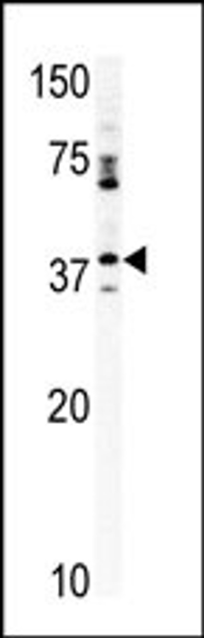 Western blot analysis of anti-CCRK Pab in mouse kidney tissue lysate (35ug/lane)