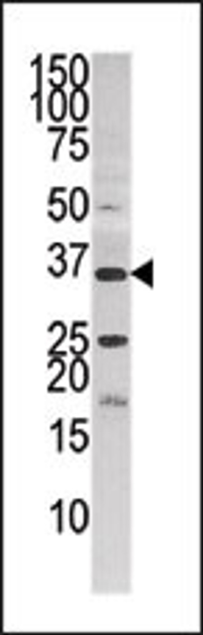 Western blot analysis of anti-PANK3 in HepG2 cell line lysate (35ug/lane) .