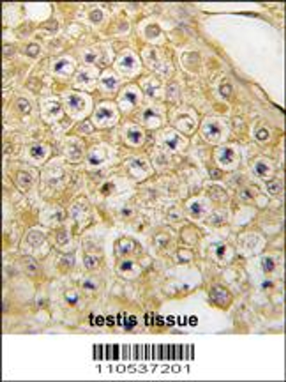 Formalin-fixed and paraffin-embedded human testis tissue reacted wit, which was peroxidase-conjugated to the secondary antibody, followed by DAB staining.