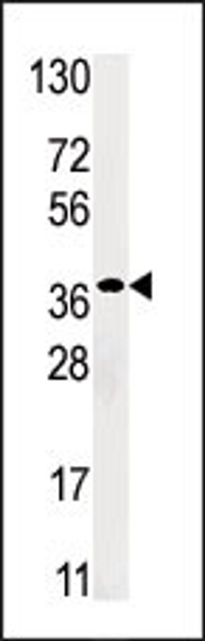 Western blot analysis of anti-RBSK Pabin HepG2 cell line lysate (35ug/lane)