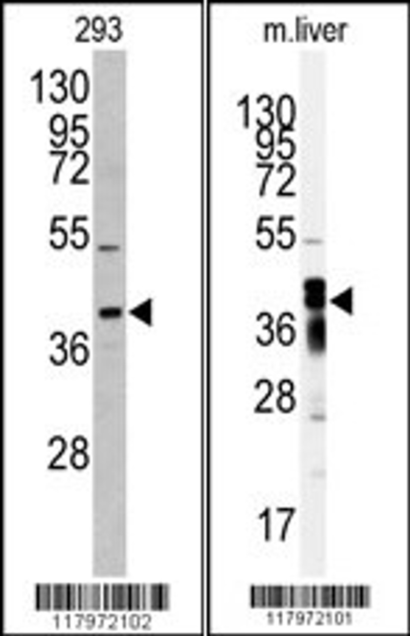 Western blot analysis of anti-AKR7A2 antibody in 293 cell line lysates (35ug/lane) Western blot analysis of anti-AKR7A2 Antibody in mouse liver tissue lysates (35ug/lane) .