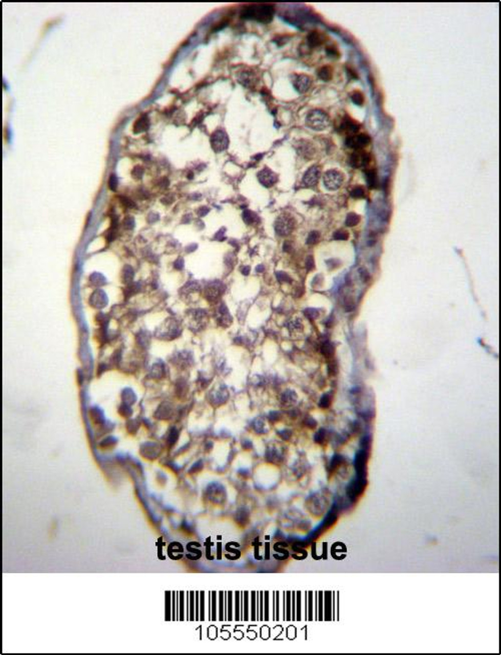 UCK2 Antibody immunohistochemistry analysis in formalin fixed and paraffin embedded human testis tissue followed by peroxidase conjugation of the secondary antibody and DAB staining.