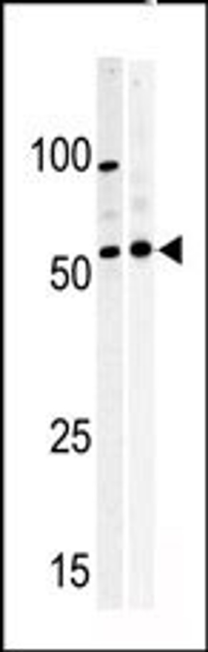 Western blot analysis of anti-PKMYT1 Pabin A375 (left) and Y79 (right) cell line lysate.