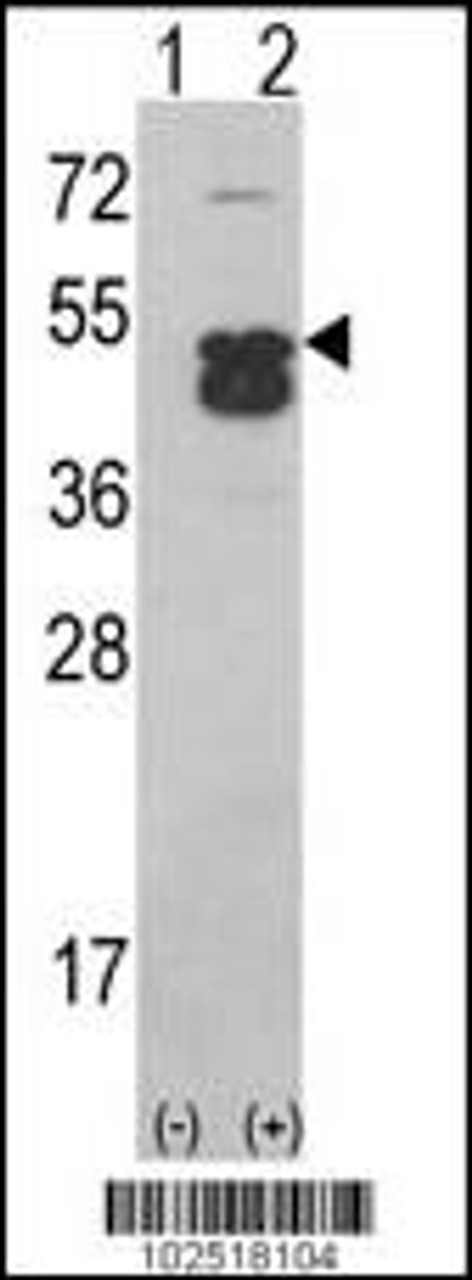 Western blot analysis of CAMK1D using CAMK1D (CAMK1 delta) Antibody using 293 cell lysates (2 ug/lane) either nontransfected (Lane 1) or transiently transfected with the CAMK1D gene (Lane 2) .