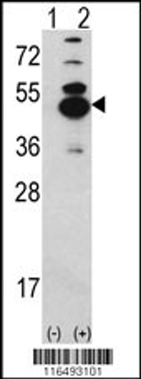 Western blot analysis of CAMK1D using rabbit polyclonal CAMK1D Antibody using 293 cell lysates (2 ug/lane) either nontransfected (Lane 1) or transiently transfected with the CAMK1D gene (Lane 2) .