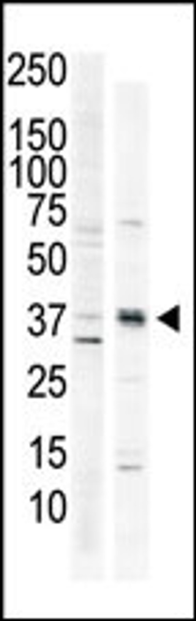Antibody is used in Western blot to detect CAMK1 in HeLa cell lysate (lane 1) and primate brain tissue lysate (lane 2) .