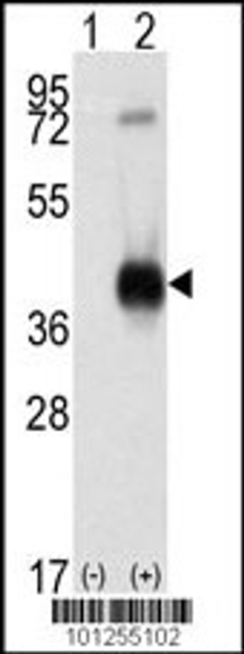 Western blot analysis of CAMK1 using rabbit polyclonal CAMK1 Antibody using 293 cell lysates (2 ug/lane) either nontransfected (Lane 1) or transiently transfected with the CAMK1 gene (Lane 2) .