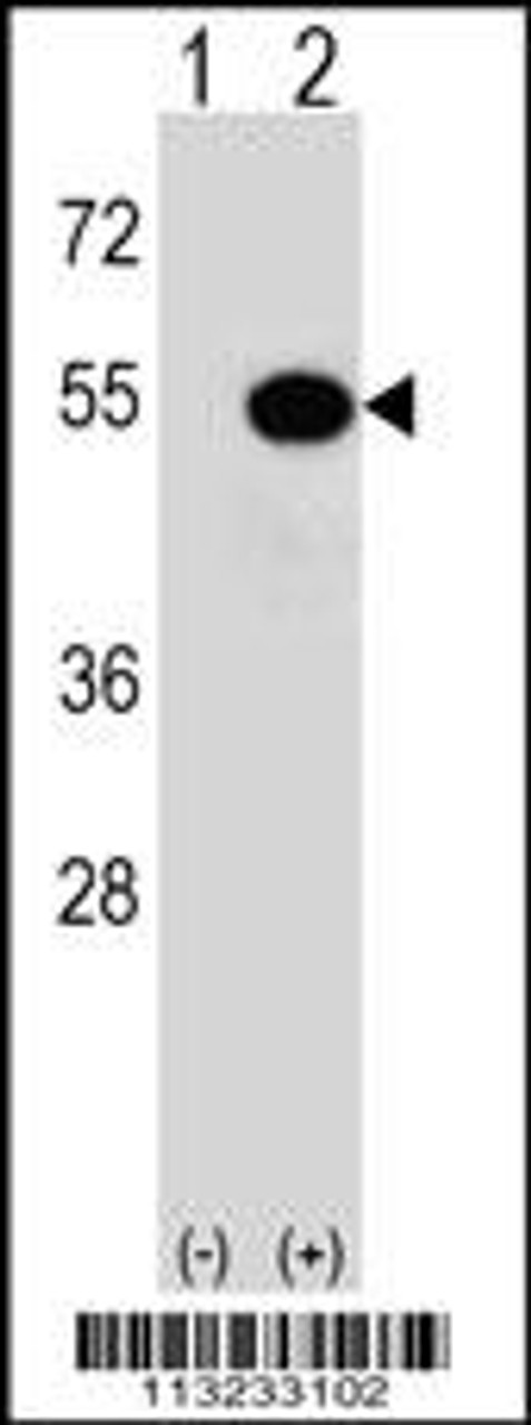 Western blot analysis of MAPKAPK5 using rabbit polyclonal MAPKAPK5 Antibody (T182) using 293 cell lysates (2 ug/lane) either nontransfected (Lane 1) or transiently transfected (Lane 2) with the MAPKAPK5 gene.