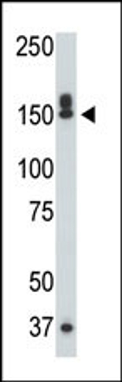 Antibody is used in Western blot to detect DAPK1 in mouse liver tissue lysate.