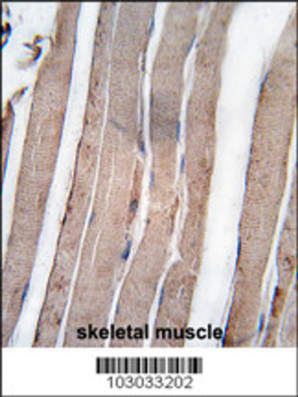 Formalin-fixed and paraffin-embedded human skeletal muscle tissue reacted with DAPK1 antibody, which was peroxidase-conjugated to the secondary antibody, followed by DAB staining.