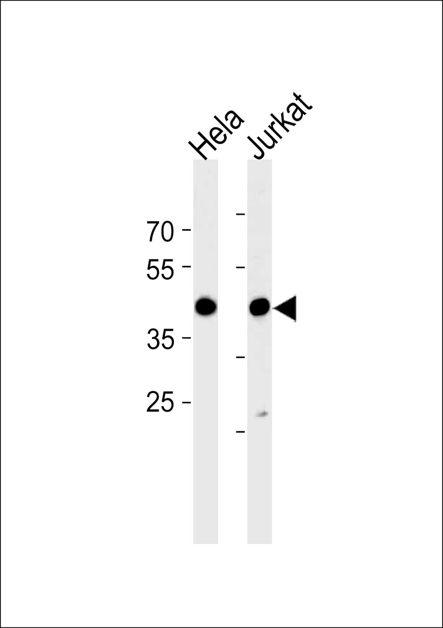 Western blot analysis in Hela and Jurkat cell line lysates (35ug/lane) .