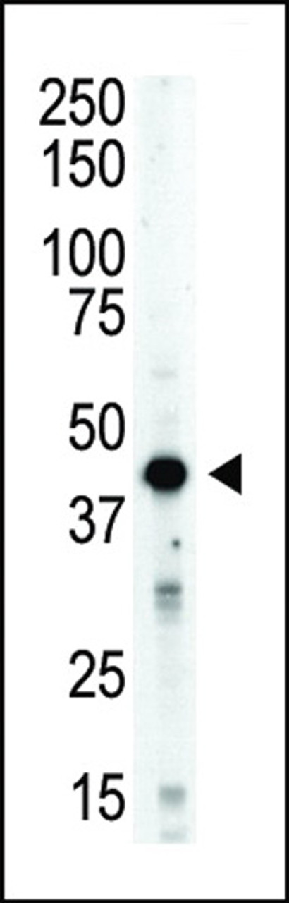 Antibody is used in Western blot to detect STK12 in mouse spleen tissue lysate.