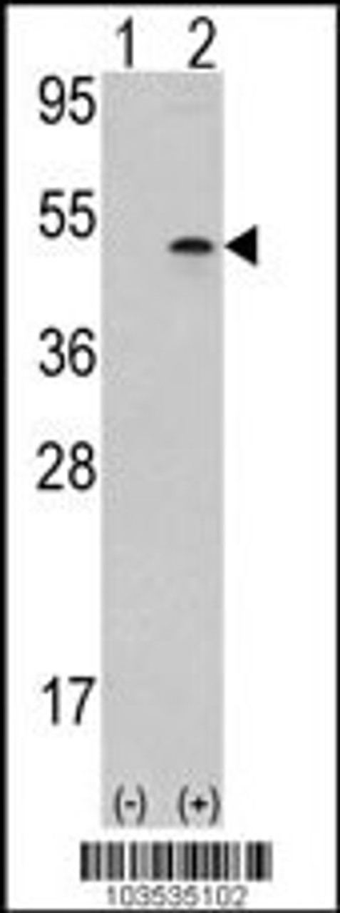 Western blot analysis of AURKB using rabbit polyclonal Aurora-B (ARK/STK12) Antibody using 293 cell lysates (2 ug/lane) either nontransfected (Lane 1) or transiently transfected with the AURKB gene (Lane 2) .