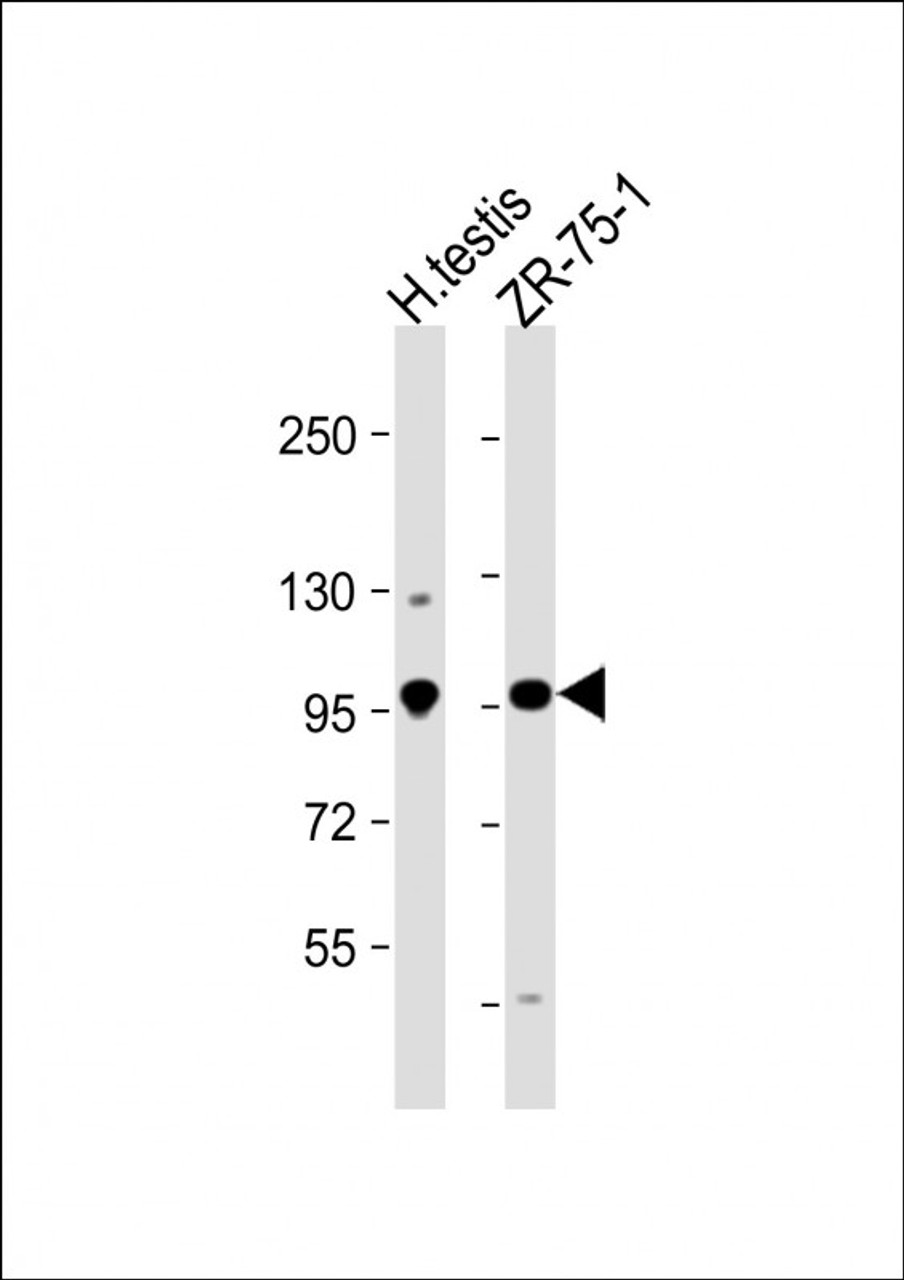 Western Blot at 1:1000 dilution Lane 1: human testis lysate Lane 2: ZR-75-1 whole cell lysate Lysates/proteins at 20 ug per lane.