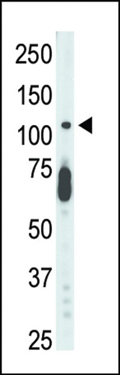 Antibody is used in Western blot to detect STK9 in mouse lung tissue lysate.