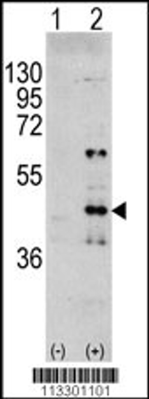 Western blot analysis of MAPK3 using rabbit polyclonal MAPK3 Antibody (Y204) using 293 cell lysates (2 ug/lane) either nontransfected (Lane 1) or transiently transfected with the MAPK3 gene (Lane 2) .