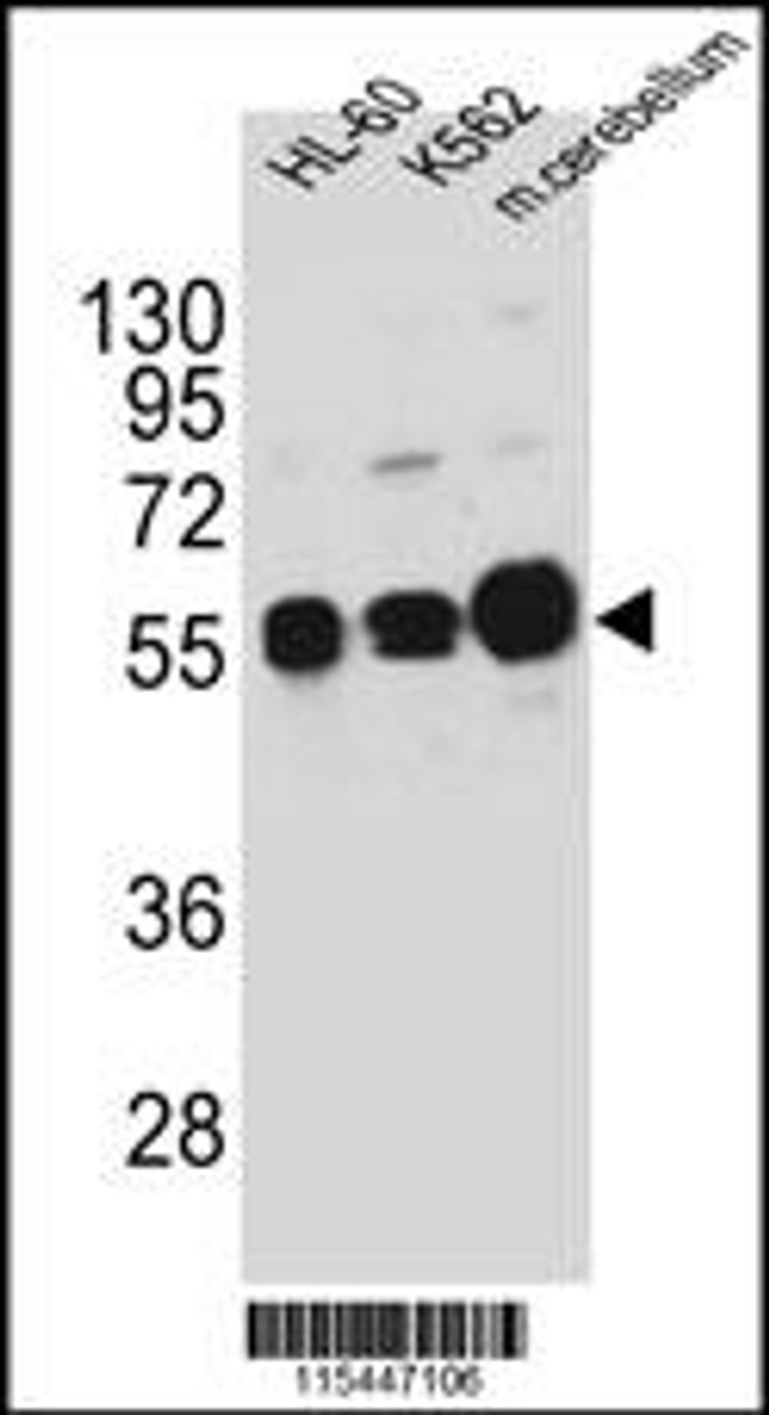 Western blot analysis in HL-60, K562 cell line and mouse cerebellum tissue lysates (35ug/lane) .This demonstrates the CAMK1G antibody detected the CAMK1G protein (arrow) .