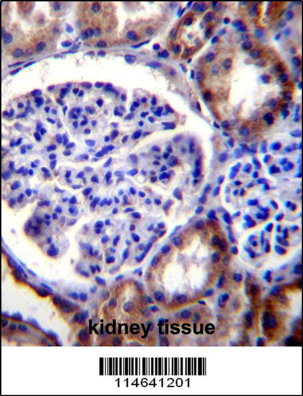 RICTOR Antibody immunohistochemistry analysis in formalin fixed and paraffin embedded human kidney tissue followed by peroxidase conjugation of the secondary antibody and DAB staining.