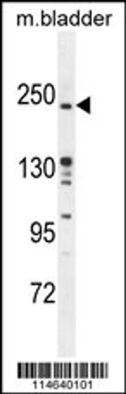 Western blot analysis in mouse bladder tissue lysates (35ug/lane) .