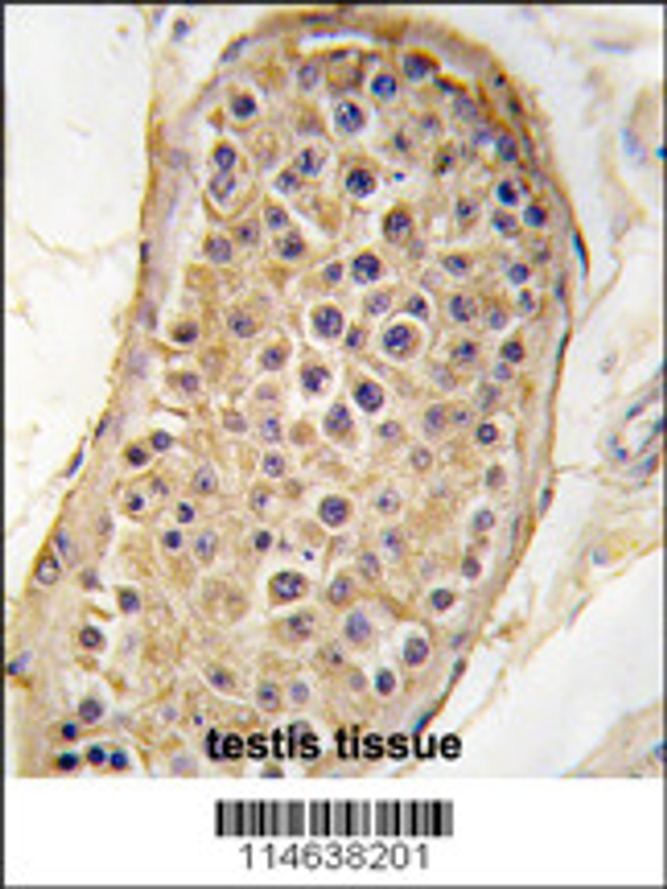 Formalin-fixed and paraffin-embedded human testis tissue reacted with RICTOR antibody, which was peroxidase-conjugated to the secondary antibody, followed by DAB staining.