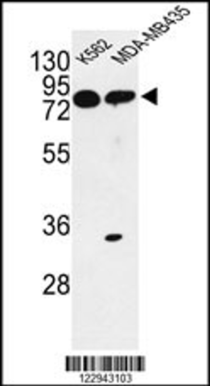 Western blot analysis of PRKAA1 Antibody in K562, MDA-MB435 cell line lysates (35ug/lane)