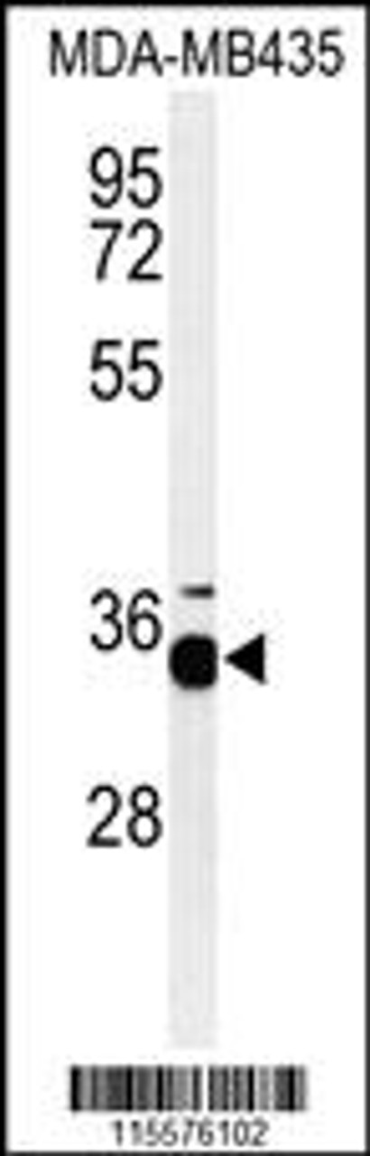 Western blot analysis of PHB2-Y248in MDA-MB435 cell line lysates (35ug/lane)