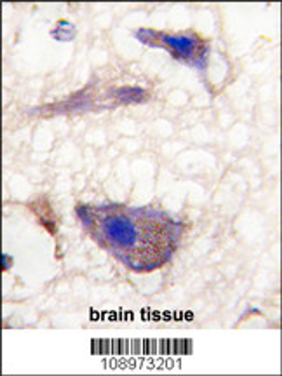 Formalin-fixed and paraffin-embedded human brain tissue reacted with Nptx1 Antibody, which was peroxidase-conjugated to the secondary antibody, followed by DAB staining.