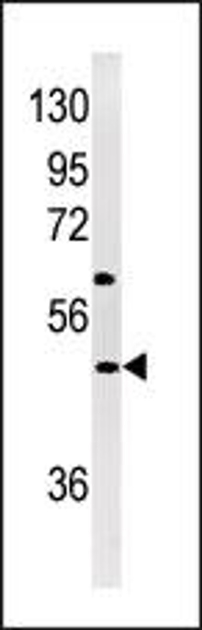 Western blot analysis of in Jurkat cell line lysates (35ug/lane)