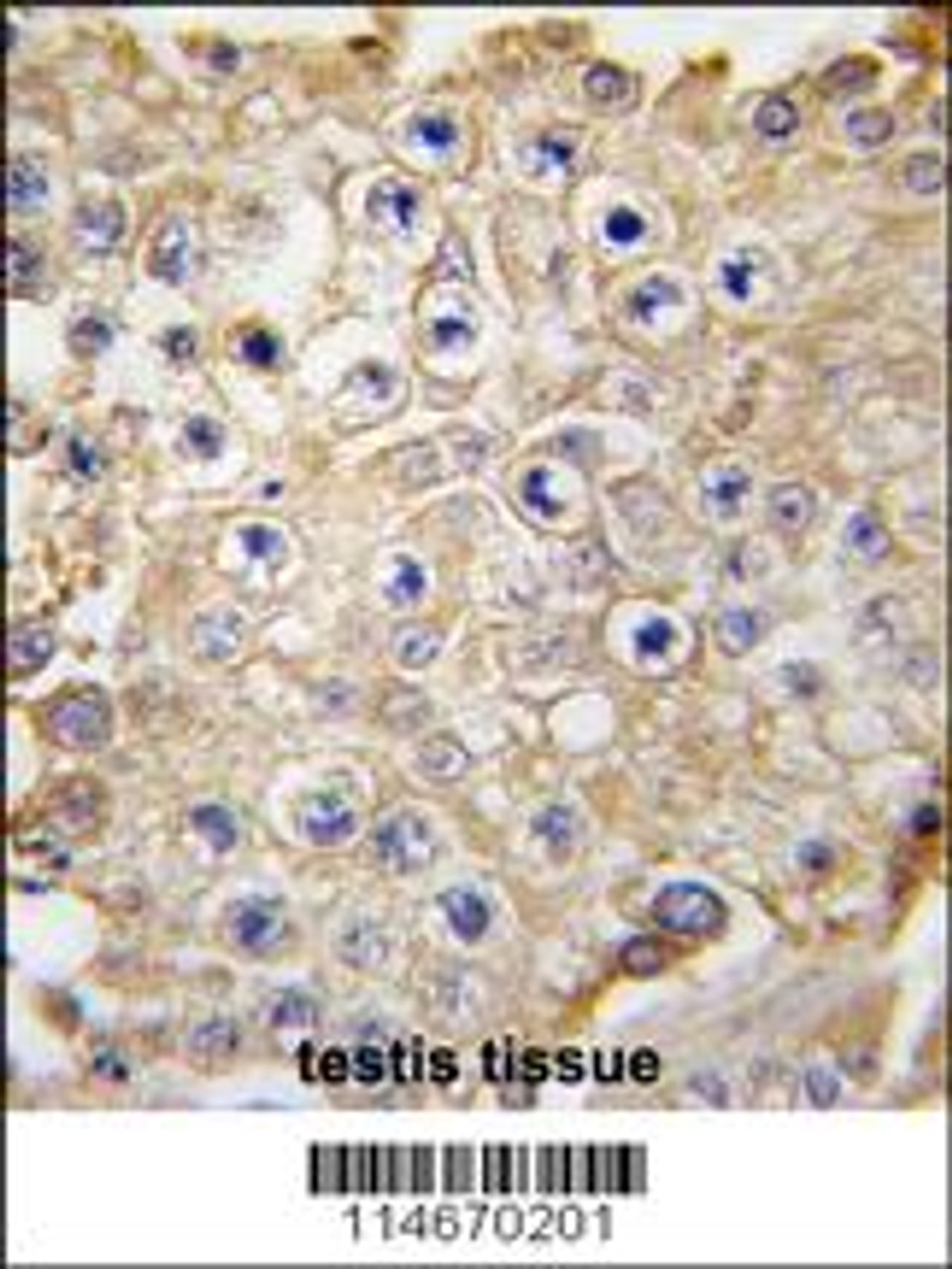 Formalin-fixed and paraffin-embedded human testis tissue reacted with APPBP1 antibody, which was peroxidase-conjugated to the secondary antibody, followed by DAB staining.