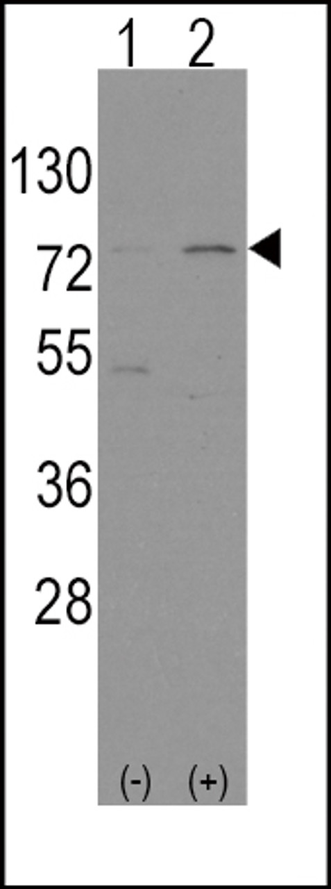 Western blot analysis of Nrf2 (Nfe2l2) using rabbit polyclonal Nrf2 (Nfe2l2) Antibody using 293 cell lysates (2 ug/lane) either nontransfected (Lane 1) or transiently transfected with the Nrf2 (Nfe2l2) gene (Lane 2) .