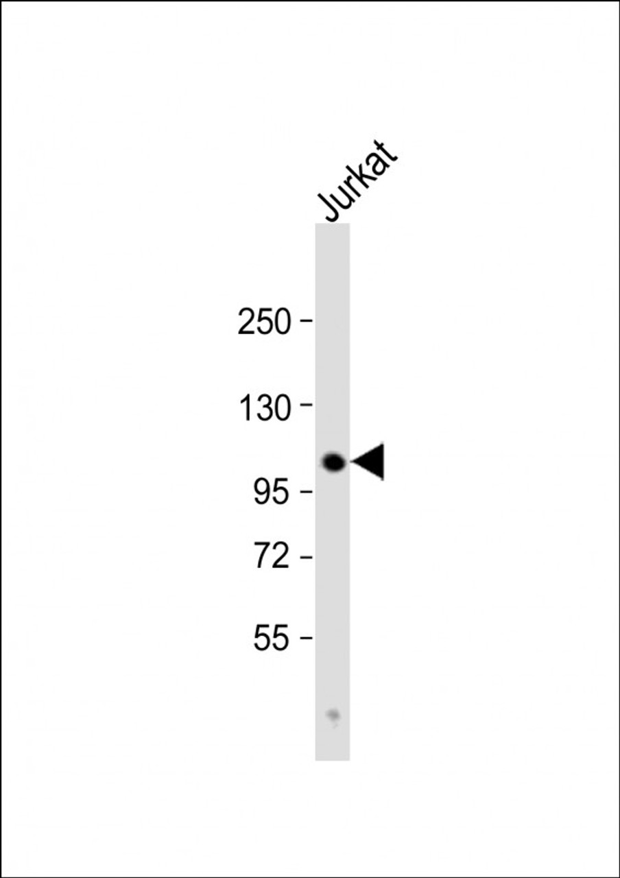 Western Blot at 1:1000 dilution + Jurkat whole cell lysate Lysates/proteins at 20 ug per lane.