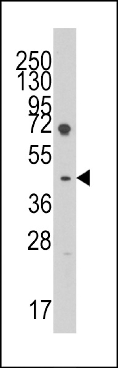 Western blot analysis of anti-LEFTB Pab in HL60 cell line lysates (35ug/lane) .