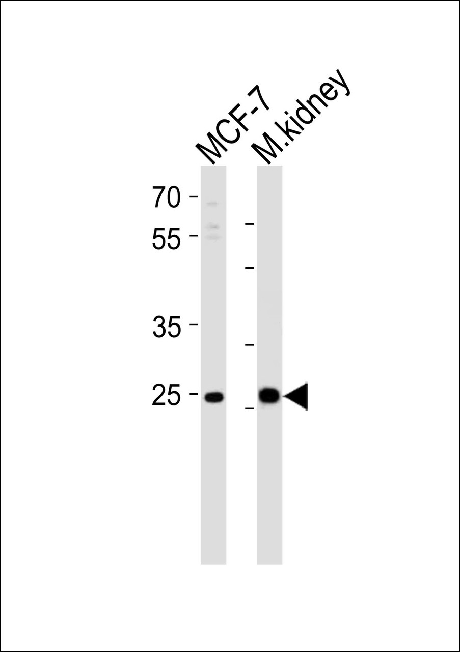 Western blot analysis of lysates from MCF-7 cell line and mouse kidney tissue lysate (from left to right) , using CA2 Antibody at 1:1000 at each lane.