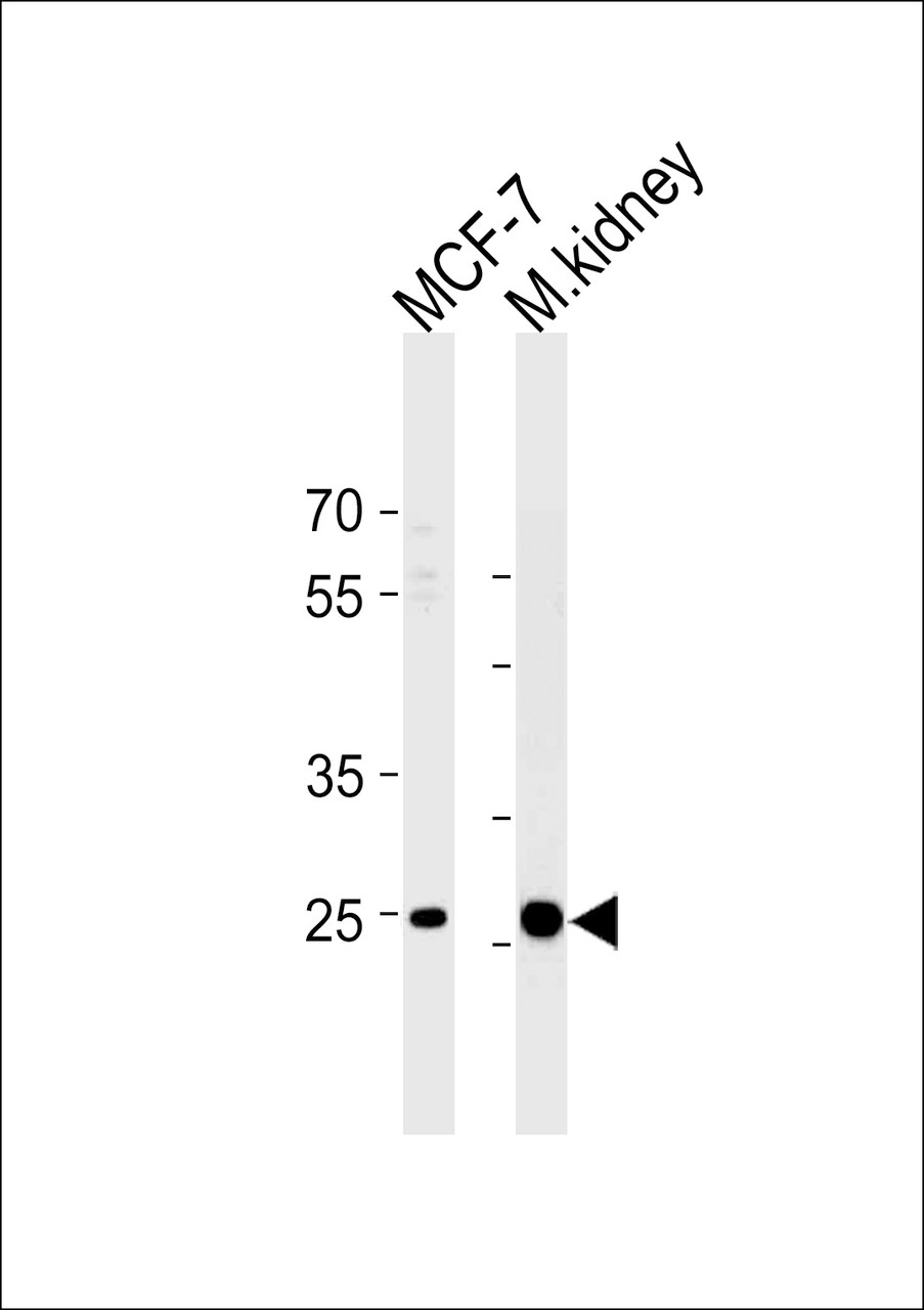 Western blot analysis in MCF-7 cell line and mouse kidney tissue lysates (35ug/lane) .