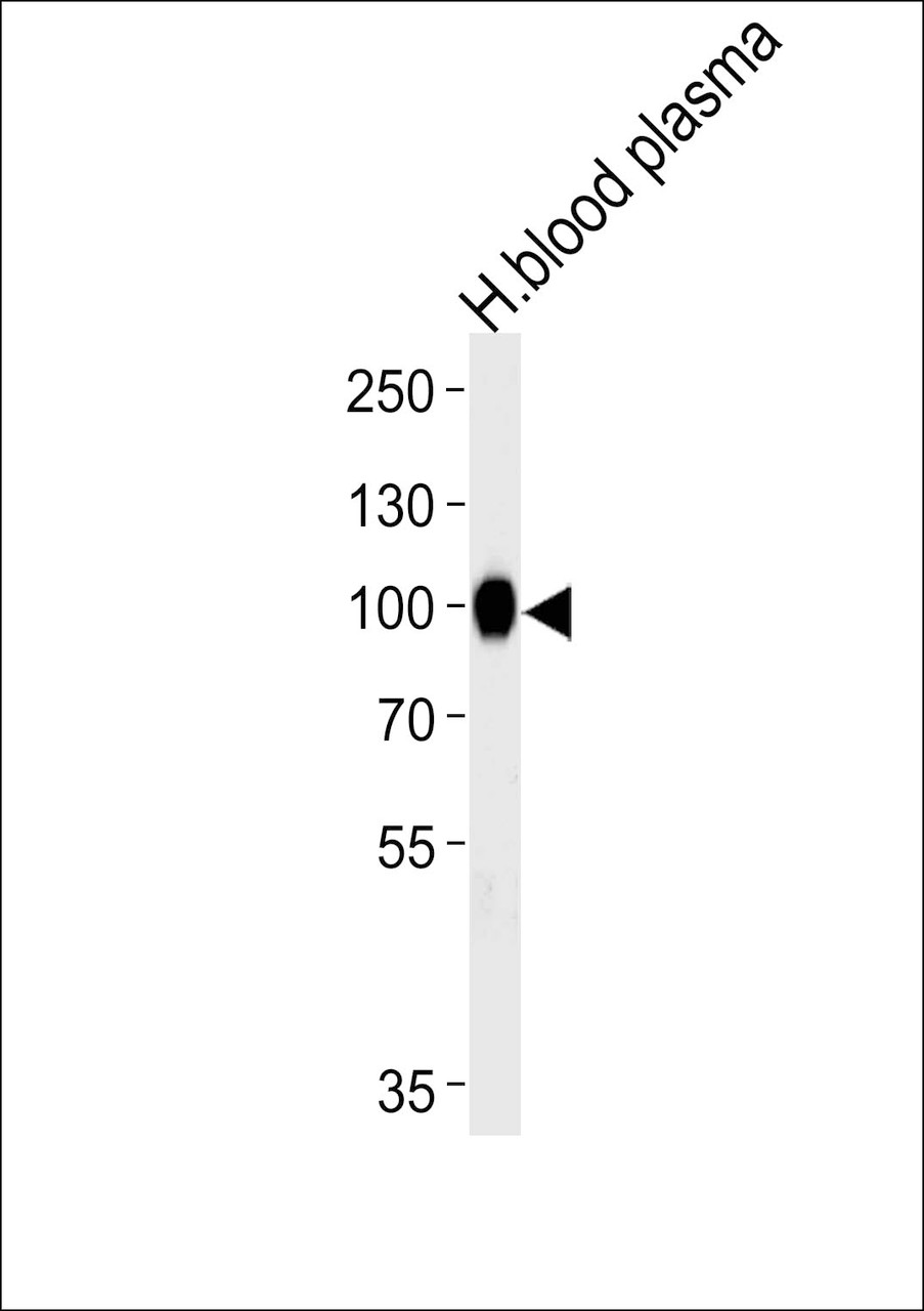 Western blot analysis of lysate from human blood plasma tissue lysate, using PLG Antibody at 1:1000 at each lane.