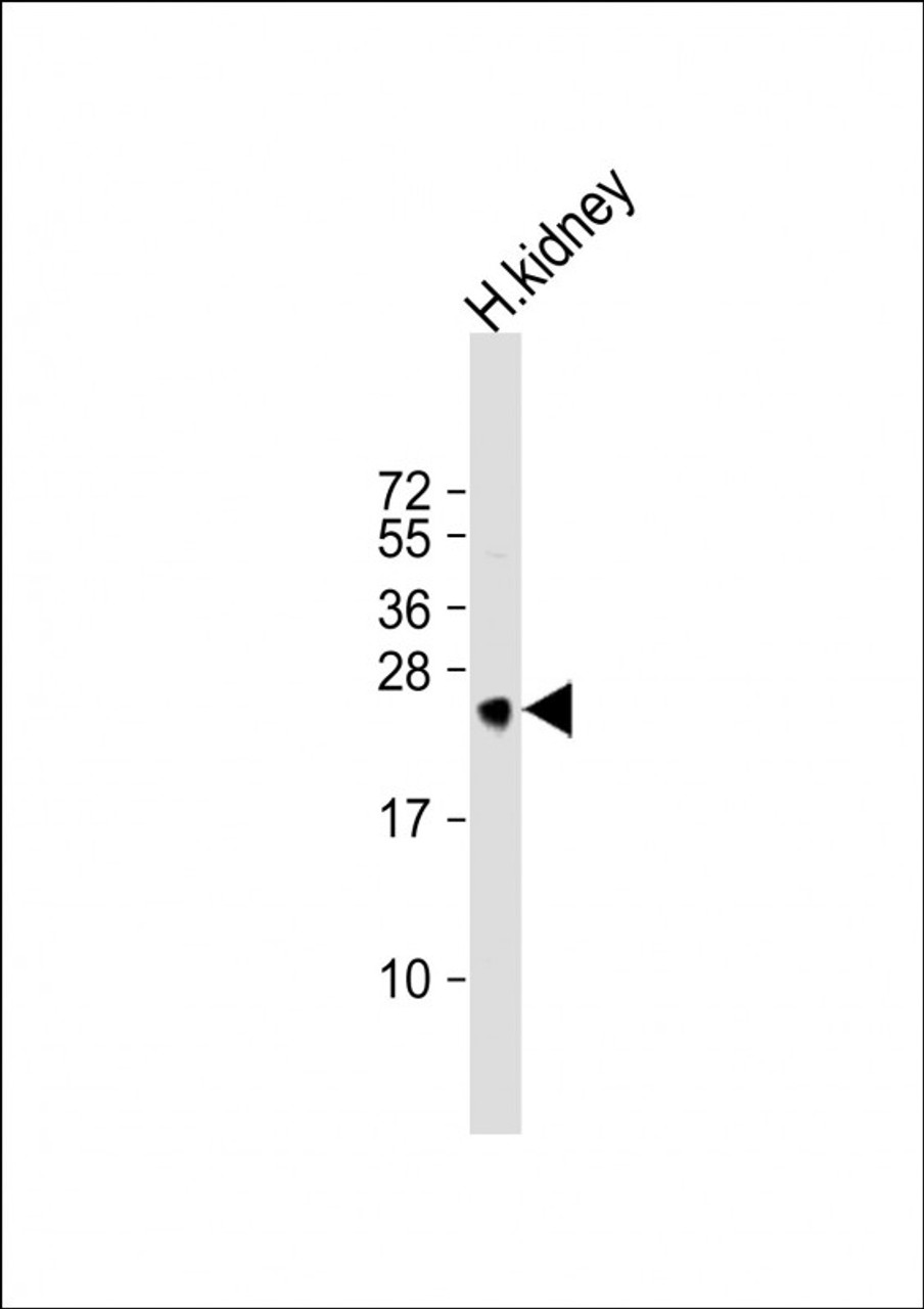 Western Blot at 1:1000 dilution + human kidney lysate Lysates/proteins at 20 ug per lane.