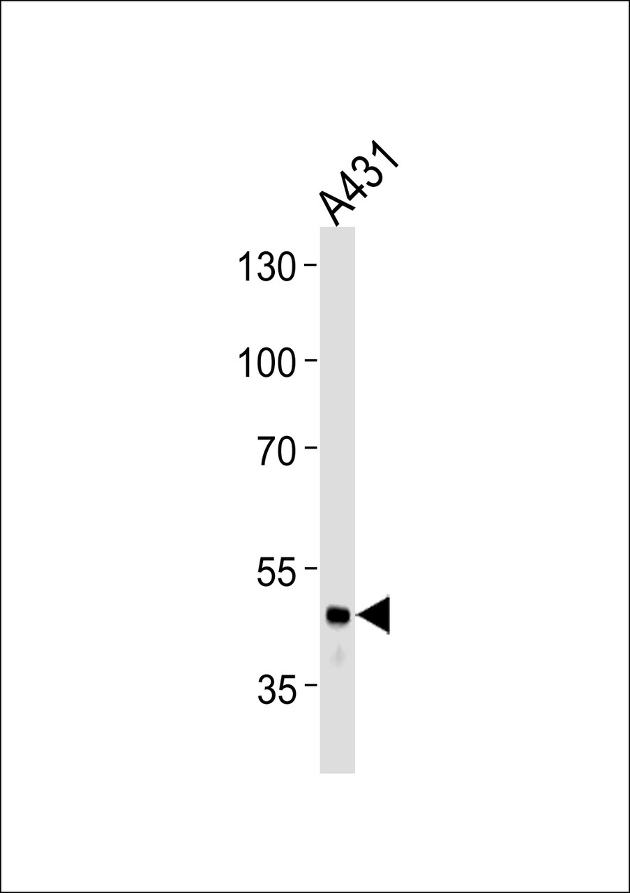 Western blot analysis in A431 cell line lysates (35ug/lane) .