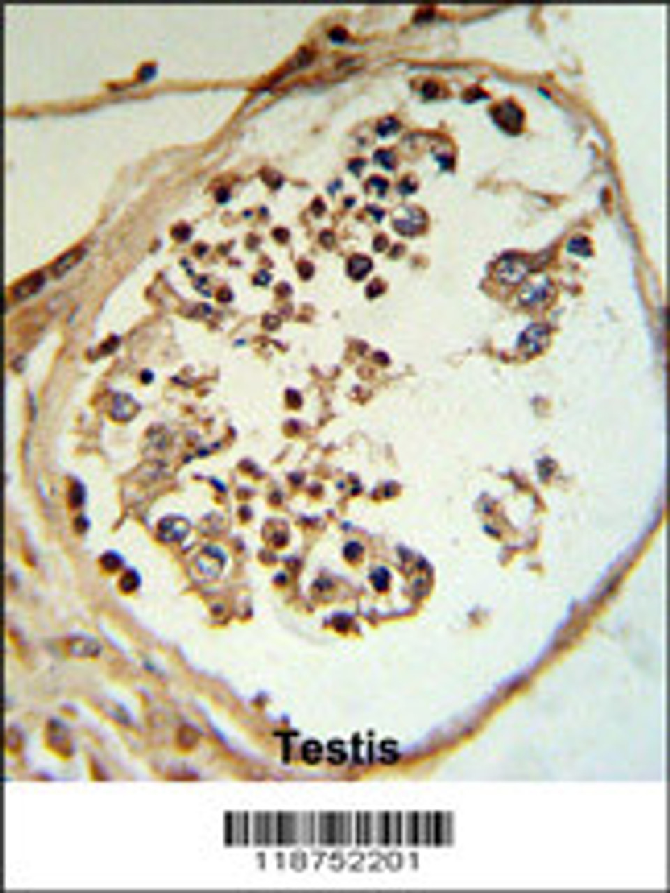 LYAR Antibody (RB18752) IHC analysis in formalin fixed and paraffin embedded human testis tissue followed by peroxidase conjugation of the secondary antibody and DAB staining.