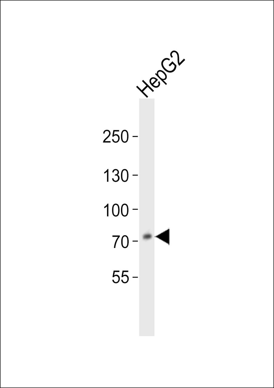 Western blot analysis of lysate from HepG2 cell line, using PCSK9 Antibody at 1:1000.